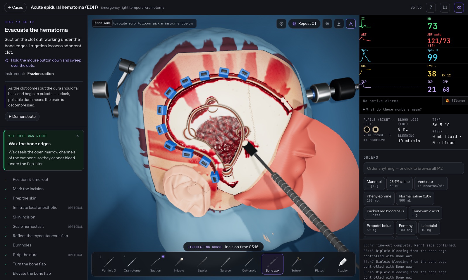 Synapse operating room: a craniotomy in progress with the instrument tray and live vitals
